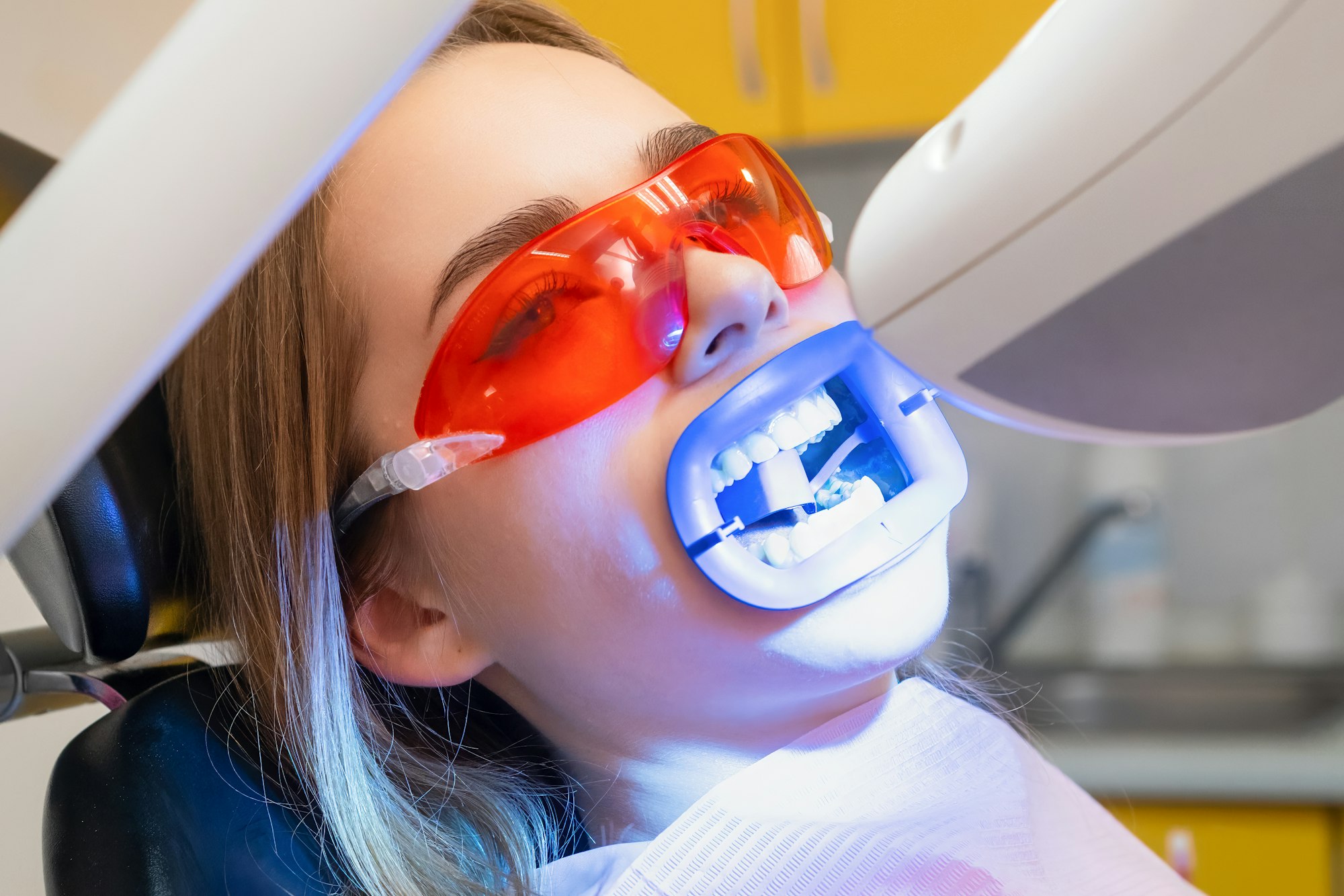 UV lamp shines on the patiens teeth during teeth whitening at dentist clinic